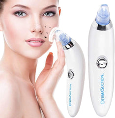 Blackhead Remover Pore Vacuum Cleaner – 5 Suction Levels & 4 Probes (USB Rechargeable)